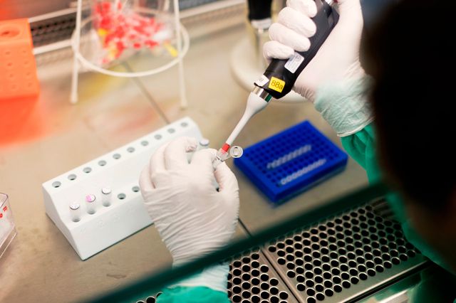 Zwei Eiweisse identifiziert: Ein Mitarbeiter der medizinischen Virologie führt einen HIV-Suchtest durch. (Archivbild)